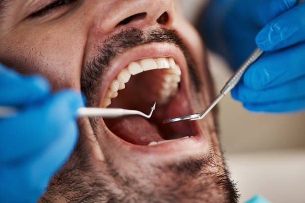 Best Tooth Infection Emergency Dentist  in Winton, CA